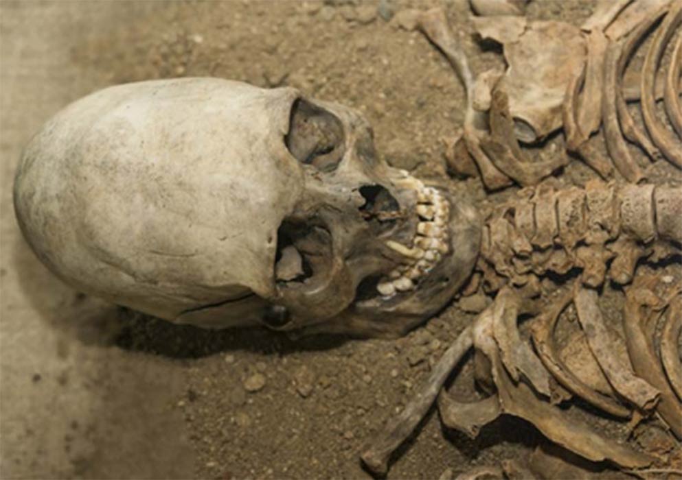 An elongated skull ( gerasimov174 / Adobe Stock)