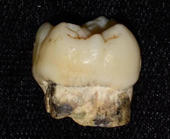 A 2 million-year-old tooth of an early human ancestor. 